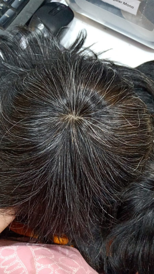 Ritzkart Salt & Pepper Hair Patch 20% Black 80% Grey Human Hair Patch for Men Natural Grey Black Mix Hair System
